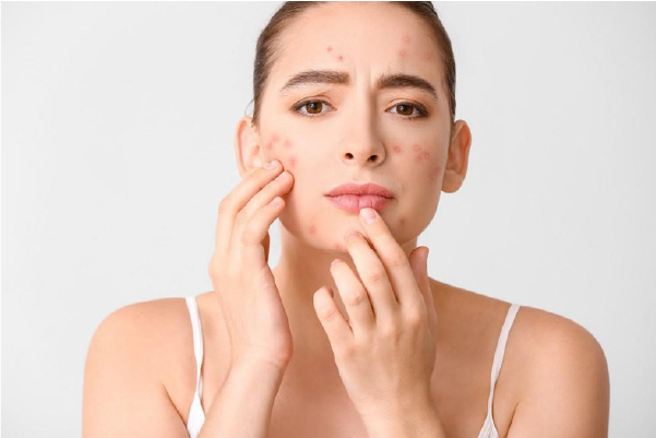 Acne treatment that works from the inside out